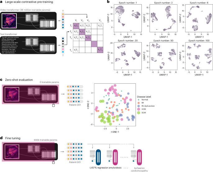 A generalizable deep studying system for cardiac MRI A generalizable deep learning system for cardiac MRI