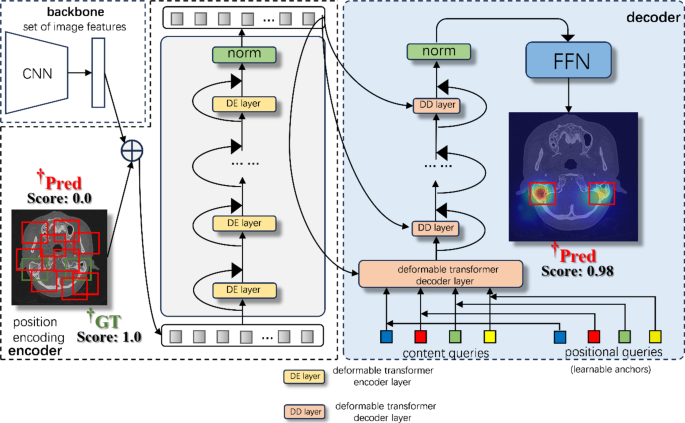 Pioneering Otitis Media Diagnosis: The 4DO-DETR Breakthrough 4DO-DETR for otitis media detection