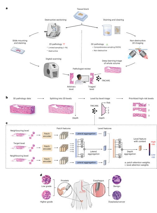 Revolutionizing Pathology: AI-Powered 3D Triage for Lightning-Fast, Precision Pathologist Insights Deep-learning triage of three-dimensional pathology datasets for comprehensive and efficient pathologist assessments