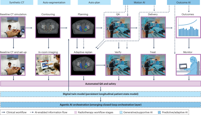 AI-Driven Radiotherapy: Redefining Precision in Cancer Treatment Delivery Optimizing the delivery of radiotherapy with artificial intelligence